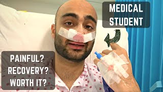 Underwent surgery 3 days before med school finals  Septoplasty VLOG  Advice [upl. by Inig]