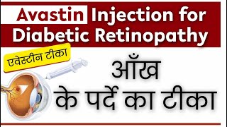 How Avastin Injection Helps Save Vision A CostEffective Solution  AvastinInjection [upl. by Keener232]