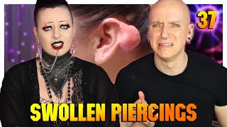 Reacting To Piercing Keloids amp Hypertrophic Scars ftToxic Tears  Piercings Gone Wrong 37  Roly [upl. by Wehtam508]