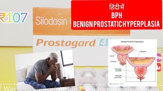 Prostagard silodosin tablet uses in Hindi BPH का ट्रीटमेंट [upl. by Entwistle280]