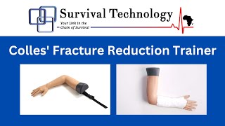 Colles Fracture Reduction Trainer [upl. by Roeser]