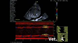 Dilated Cardiomyopathy DCM [upl. by Hedelman]