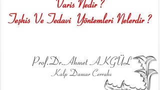 Varisin tedavisi sonrası niye tekrarlar   Prof Dr Ahmet AKGÜL  ahmetakgulTV [upl. by Anceline]