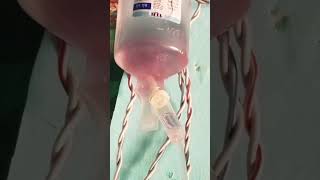 Ns500mldoctoriv drip kaise lagaye [upl. by Eislehc]