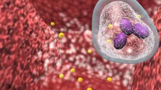 Bacterial infection and host response [upl. by Bianchi]