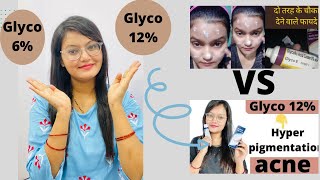 Glyco 6 cream VS Glyco 12 cream  acne prone skin  hyperpigmentation Kiransrana [upl. by Larsen176]