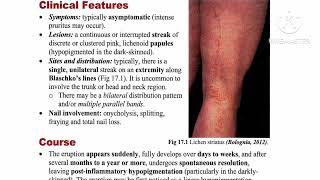 2 Lichenoid Review ✅ Lichen nitidus 🔸 Lichen striatus 🔸 Graft versus host disease by Dr Ahmed Kamel [upl. by Enyrat]