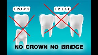 No Crown No Bridge  أستثمر بالمستقبل [upl. by Sonahpets]