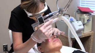 Photofacial Micro Laser Peel and Pro Fractional at Oceanview Med Spa in Frisco [upl. by Strong]