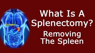 Removing The Spleen  What Is A Splenectomy [upl. by Fritzie]