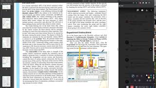 PhysioEx Ex 5 Activity 6 [upl. by Eaner]