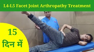 L4L5 Facet Joint Arthropathy Treatment in 15 Days  Slip Disc treatment by dr mukesh sharma [upl. by Kablesh]