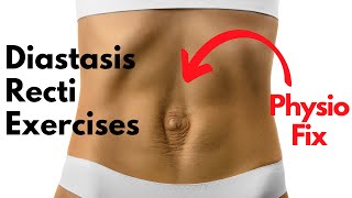 How to START Diastasis Recti Exercises that FIX YOUR GAP  PHYSIO GUIDED Abdo Separation Repair [upl. by Ayota]