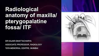 Radiological anatomy of maxillapterygopalatine fossa infratemporal fossa  Dr Kajari Bhattacharya [upl. by Gerick]