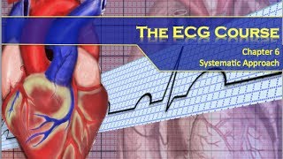 The ECG Course  Systematic Approach [upl. by Caplan610]