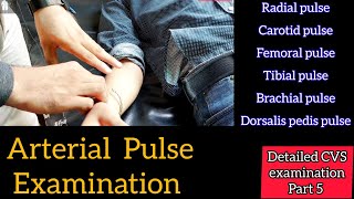 Pulse Examination  CVS examination part 5 [upl. by Llenrev80]