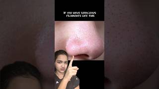 This remove sebaceous filaments on nose 😳 [upl. by Mosley]