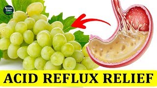 How To Treat Acid Reflux Fast Naturally  Heartburn Relief Instantly [upl. by Lehcsreh]