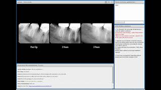 VDW Dental · Webinar The Endodontic Essentials with Dr Marino Sutedjo EN [upl. by Ahsieken792]