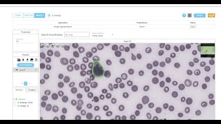 White Blood Cell Segmentation  Leukemia Diagnosis with AI  Nocode  Microscopy  AI tool [upl. by Dnomed325]