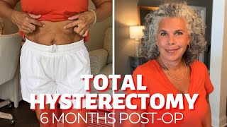 My Total Hysterectomy Experience  What to Expect After Laparoscopic Hysterectomy 6 Months PostOp [upl. by Selohcin]