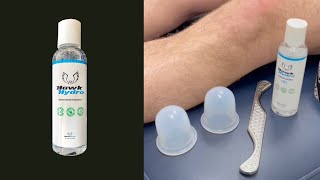 Runners Knee Pain Relief IASTM Cupping amp Taping with HawkHydro [upl. by Inesita]