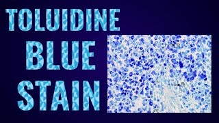 Toluidine Blue Stain [upl. by Ecinnahs]