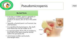 Micropenis and Delayed Puberty A Comprehensive Approach to Diagnosis and Treatment Prof Jamal Raza [upl. by Alieka]