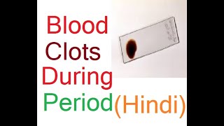 पीरियड में blood clots खून के थक्के आना – माहवारी मासिक धर्म में खून के काले थक्के आना [upl. by Phedra]