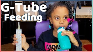 Our GTube Feeding Process  Squeasy  Real Food Blends [upl. by Halla]