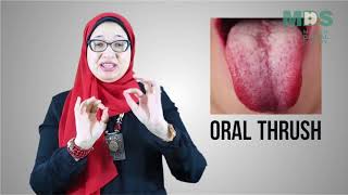 lecture 1 oral medicine MJDF part 1 revision by Master Key Academyالزمالات البريطانيه [upl. by Walburga97]