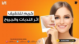 كريم لتخفيف اثر الندبات والجروح [upl. by Airamat]