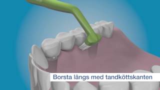 Rengör dina tandimplantat från insidan med TePe Implant Care™ [upl. by Llirret]