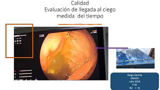 IA en endoscopia digestiva [upl. by Ruford191]