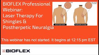 Laser Therapy For Shingles amp Postherpetic Neuralgia [upl. by Caritta]