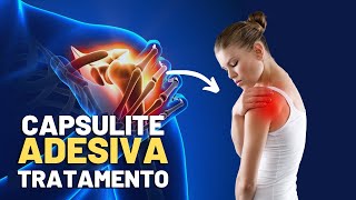 PILATES CAPSULITE ADESIVAOMBRO CONGELADO  Faça esse tratamento e acabe com sua dor [upl. by Ragas638]