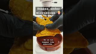 Snacks🍿 under microscope 🔬 Shocking 😳 results 💯 science lab laboratory scienceclass foryou [upl. by Berti]