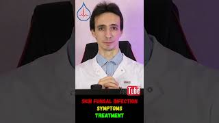 Skin fungal infection what does it look like and how to cure it [upl. by Aelsel]