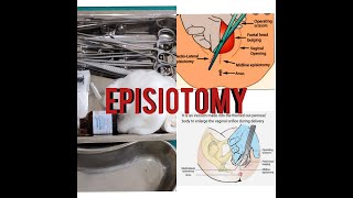 EPISIOTOMY EPISIOTOMY TRAYINSTRUMENTEASY EXPLANATIONSUSES [upl. by Raab645]