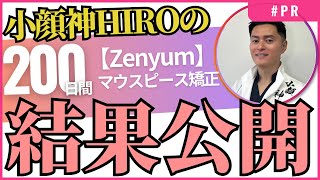 マウスピース矯正【Zenyum】200日終了！結果報告と感想をお伝えします！！PR zenyum [upl. by Gherardo]