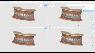 Medit Ortho Simulation 1 1 [upl. by Alanson]