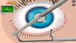 Eye Surgeon Simulator Zerschneidet das Auge HD [upl. by Hgielhsa104]