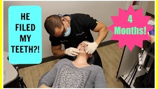 4 MONTH BRACES UPDATE  Visit To My Ortho [upl. by Aida]