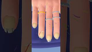 Finger amp nail treatment  nail treatment  nailtreatmentfingertreatment [upl. by Nawyt746]