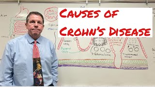 Causes of Crohn’s Disease [upl. by Leirda]