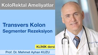 KOLOREKTAL AMELİYATLARI3 Transvers Kolon Segmenter Rezeksiyonu [upl. by Kenweigh]