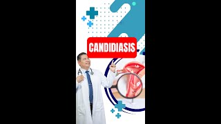 ¿Qué es la candidiasis🌸🔥 [upl. by Danete323]