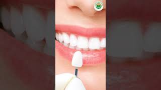 Composite vs Porcelain Veneers Expert Advice [upl. by Eicarg]