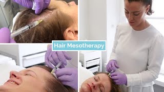 Hair Loss Mesotherapy  The Laser and Skin Clinic [upl. by Pazia]