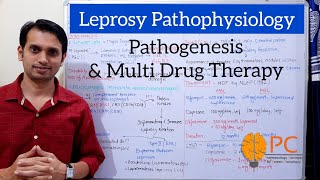 Leprosy Hansens Disease Part 2 Pathophysiology Leprosy Reaction and Multi Drug Therapy [upl. by Greenes916]